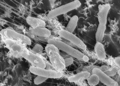 Ideonella sakaiensis – бактерия, питающаяся пластиком