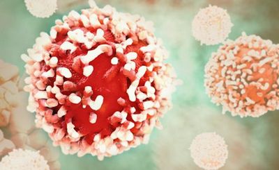 Итальянцы создают клетки, способные побеждать лейкемию - «наука»