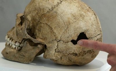 Зачем наши предки проделывали друг другу отверстия в черепе - «наука»